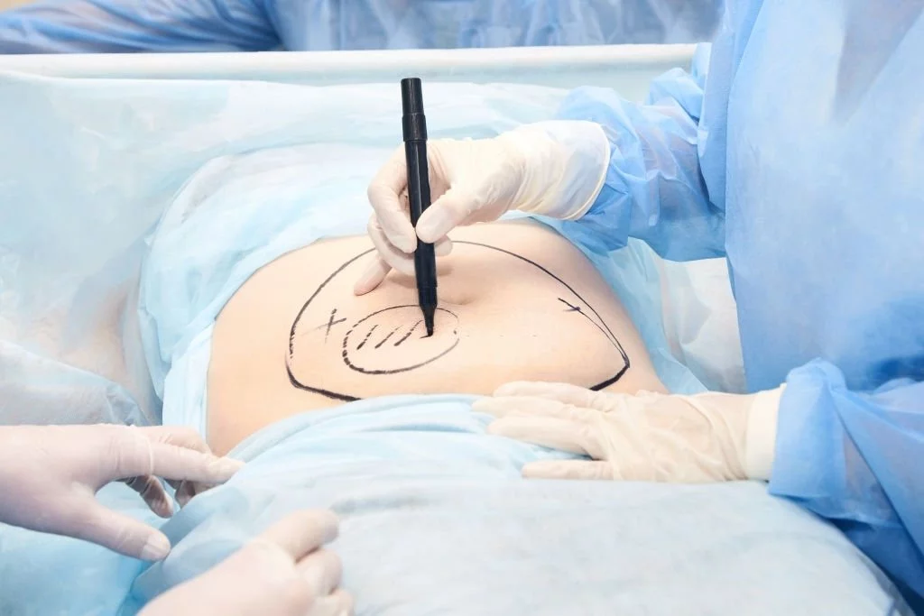 Surgery In The Womb
